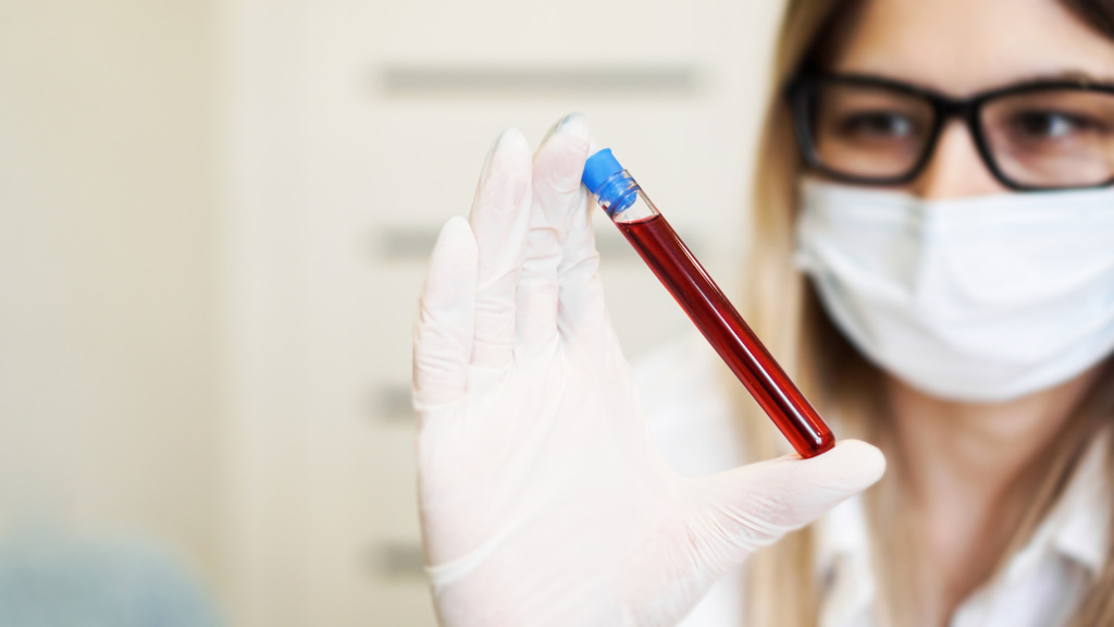 female-scientist-holding-test-tube-with-blood-sample-diagnostics-viruses-diseases.jpg