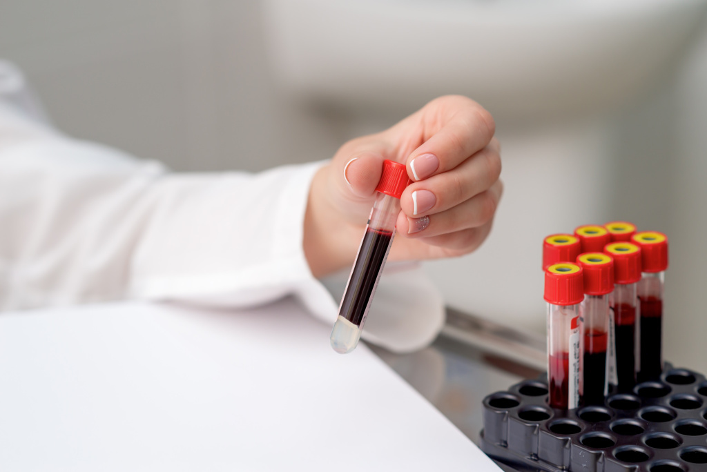 doctor-takes-blood-sample-tube-from-tray-table.jpg