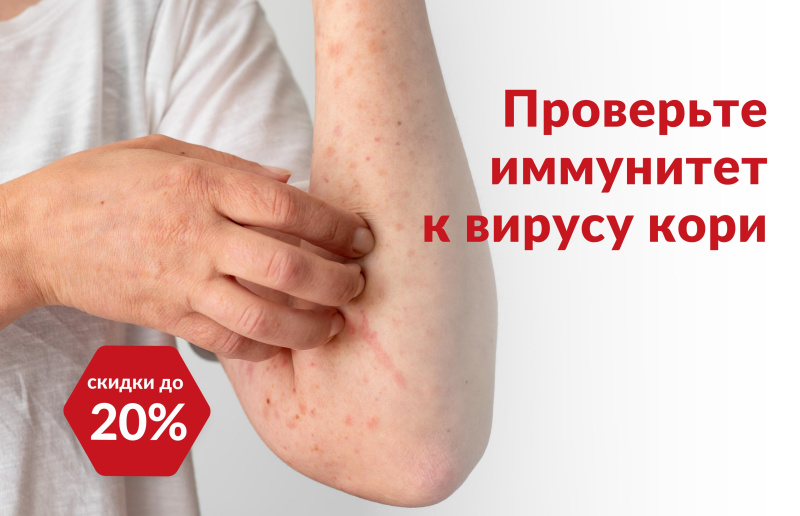 Проверьте иммунитет к вирусу кори